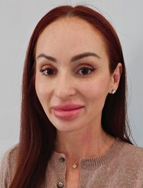 Ann Garzone